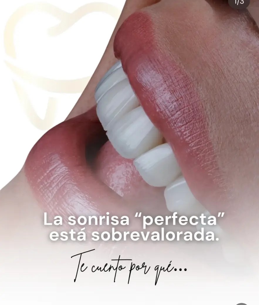 Detalle de dientes con bordes y textura pulidos